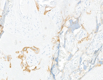 Rabbit LOX-1 Recombinant Monoclonal Antibody