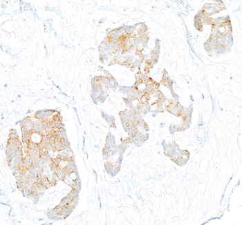 Rabbit LOX-1 Recombinant Monoclonal Antibody
