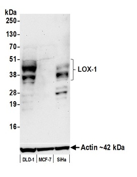 Rabbit LOX-1 Recombinant Monoclonal Antibody