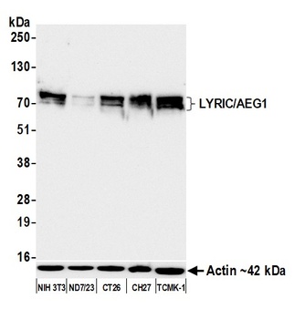 Rabbit LYRIC/AEG1 Recombinant Monoclonal Antibody