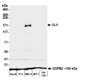 Rabbit GLI1 Recombinant Monoclonal Antibody