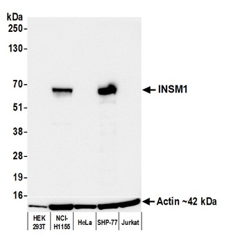 Rabbit INSM1 Recombinant Monoclonal Antibody