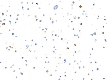 Rabbit c-Kit Recombinant Monoclonal Antibody