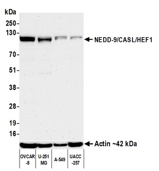 Rabbit NEDD-9/CASL/HEF1 Recombinant Monoclonal Antibody
