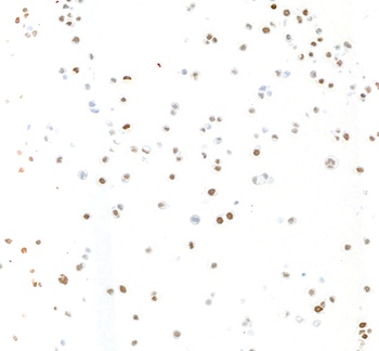 Rabbit KLF5 Recombinant Monoclonal Antibody