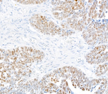 Rabbit KLF5 Recombinant Monoclonal Antibody