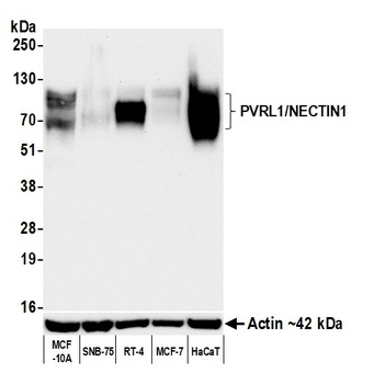 Rabbit PVRL1/NECTIN1 Recombinant Monoclonal Antibody