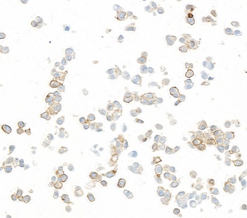 Rabbit B7-H6 Recombinant Monoclonal Antibody