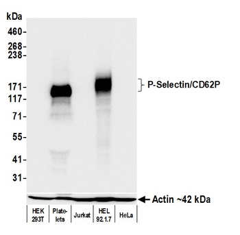 Rabbit P-Selectin/CD62P Recombinant Monoclonal Antibody