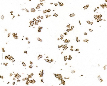 Rabbit CD70 Recombinant Monoclonal Antibody