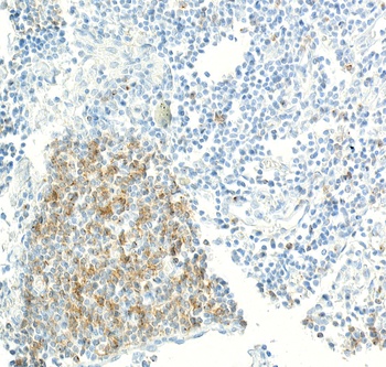 Rabbit CD70 Recombinant Monoclonal Antibody