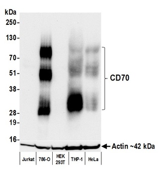 Rabbit CD70 Recombinant Monoclonal Antibody