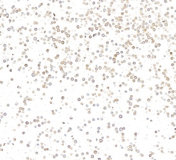 Rabbit CD36 Recombinant Monoclonal Antibody