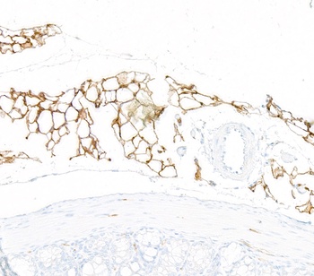 Rabbit CD36 Recombinant Monoclonal Antibody