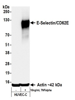 Rabbit E-Selectin/CD62E Recombinant Monoclonal Antibody