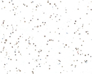 Rabbit IgM Recombinant Monoclonal Antibody