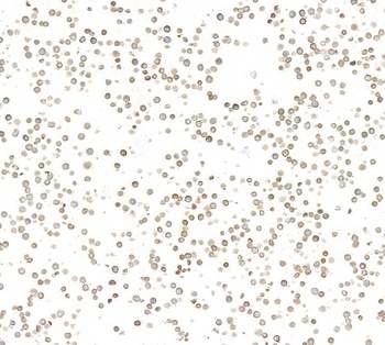 Rabbit IgM Recombinant Monoclonal Antibody