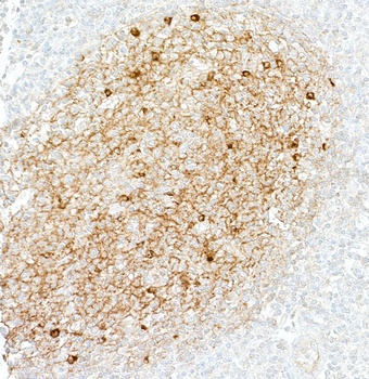 Rabbit IgM Recombinant Monoclonal Antibody