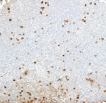 Rabbit IgM Recombinant Monoclonal Antibody