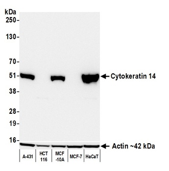 Mouse Cytokeratin 14 Recombinant Monoclonal Antibody