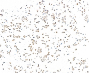 Mouse p16INK4a Recombinant Monoclonal Antibody