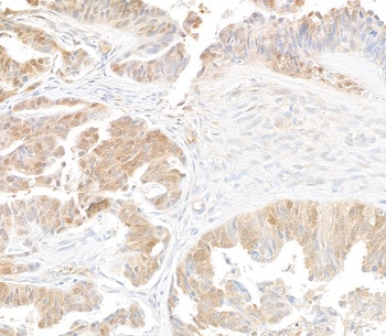 Mouse p16INK4a Recombinant Monoclonal Antibody