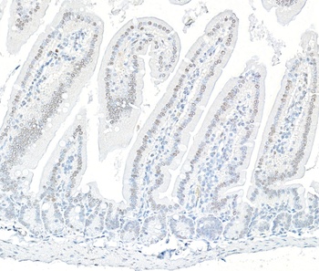 Rabbit ARID1B Recombinant Monoclonal Antibody