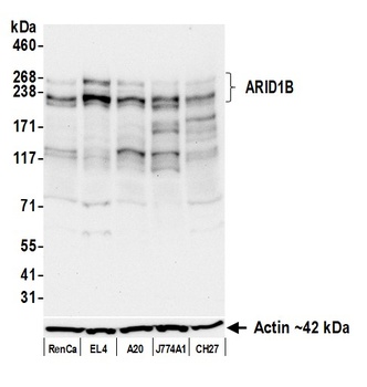 Rabbit ARID1B Recombinant Monoclonal Antibody