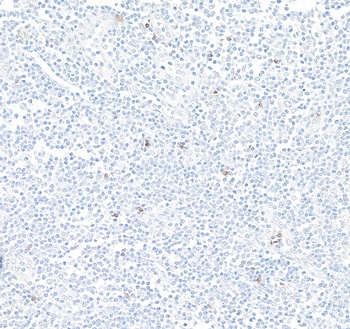Rabbit NKG2A Recombinant Monoclonal Antibody