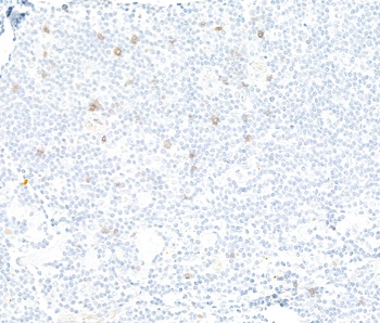 Rabbit NKG2A Recombinant Monoclonal Antibody
