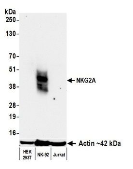 Rabbit NKG2A Recombinant Monoclonal Antibody