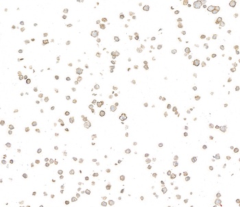 Rabbit CD39 Recombinant Monoclonal Antibody