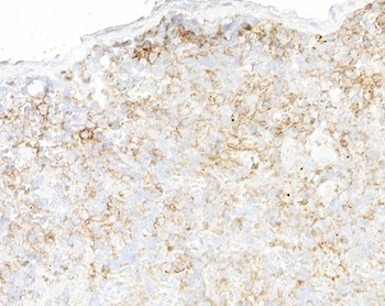 Rabbit CD39 Recombinant Monoclonal Antibody