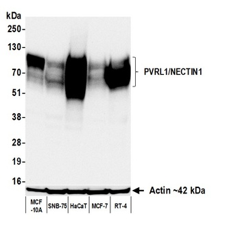 Rabbit PVRL1/NECTIN1 Recombinant Monoclonal Antibody