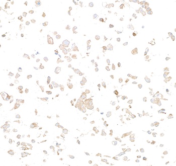 Rabbit Met Recombinant Monoclonal Antibody