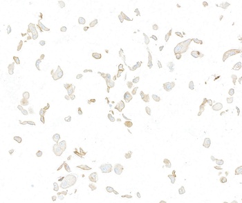Rabbit Met Recombinant Monoclonal Antibody