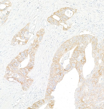 Rabbit Met Recombinant Monoclonal Antibody