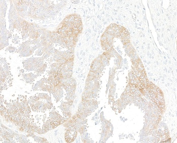 Rabbit Met Recombinant Monoclonal Antibody