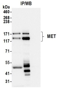 Rabbit Met Recombinant Monoclonal Antibody