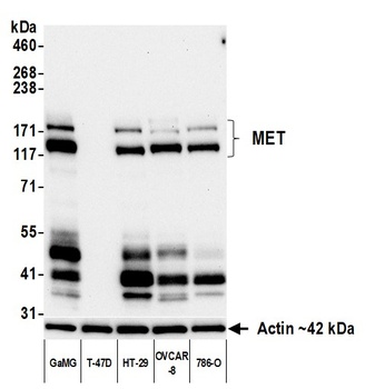 Rabbit Met Recombinant Monoclonal Antibody