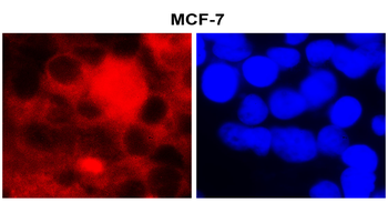 Fatty Acid Synthase Rabbit Polyclonal Antibody
