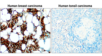 Fatty Acid Synthase Rabbit Polyclonal Antibody