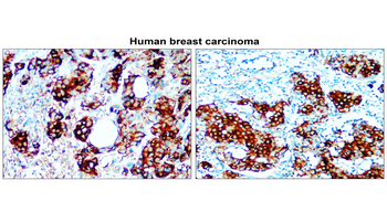 Fatty Acid Synthase Rabbit Polyclonal Antibody