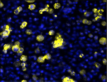 Claudin-1 Rabbit Polyclonal Antibody