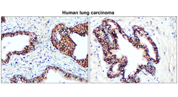 Claudin-1 Rabbit Polyclonal Antibody