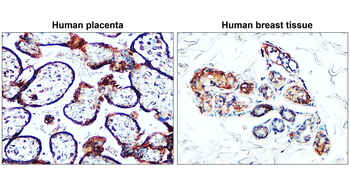 Claudin-1 Rabbit Polyclonal Antibody