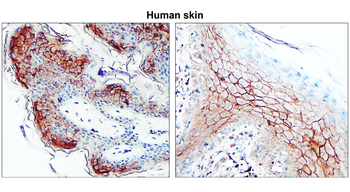 Claudin-1 Rabbit Polyclonal Antibody