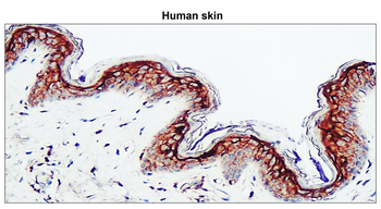 Claudin-1 Rabbit Polyclonal Antibody