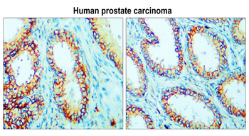 Claudin-1 Rabbit Polyclonal Antibody