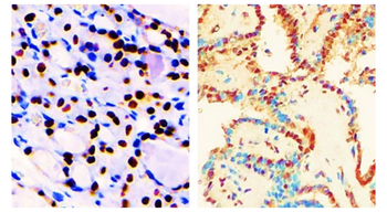 TTF-1 Rabbit Polyclonal Antibody
